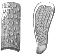 Chancre